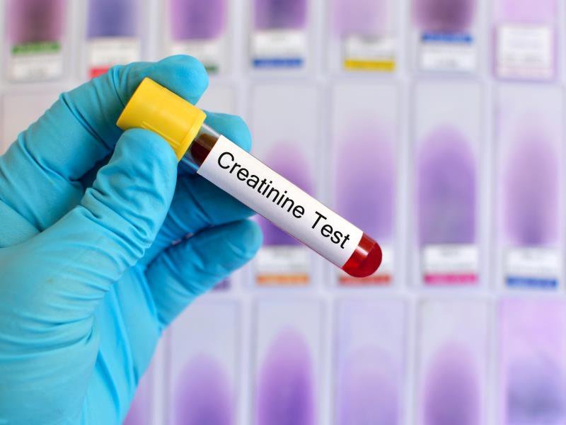 Xét nghiệm định lượng creatinin trong máu