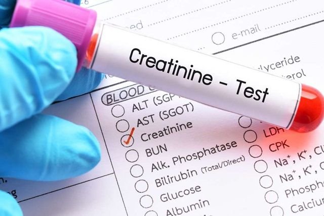 Ý nghĩa chỉ số xét nghiệm creatinin trong máu