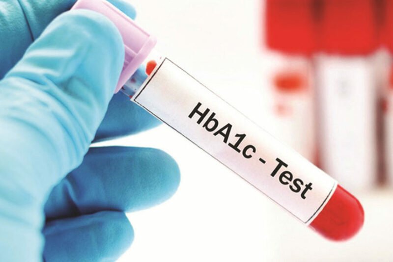 Xét nghiệm tiểu đường HbA1c