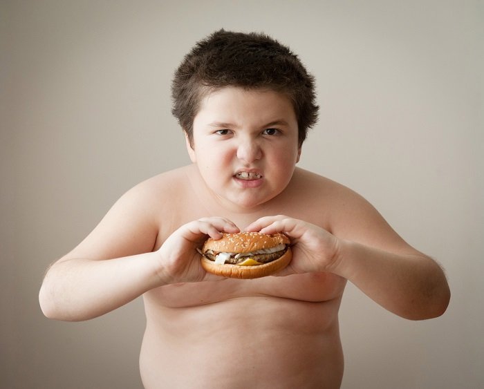 Nguyên nhân bệnh béo phì