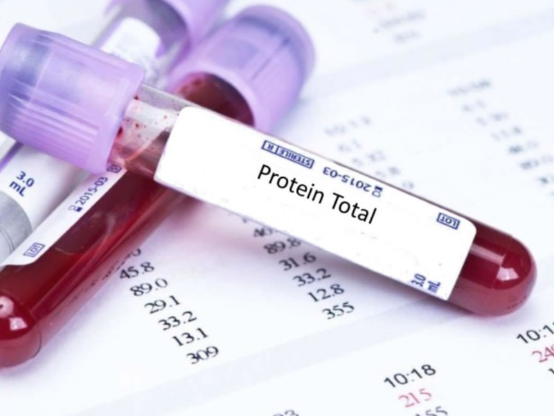 Protein máu bình thường là bao nhiêu